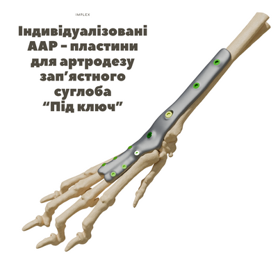 AAP - пластина для артродезу зап'ястного суглоба xS imp-5 фото